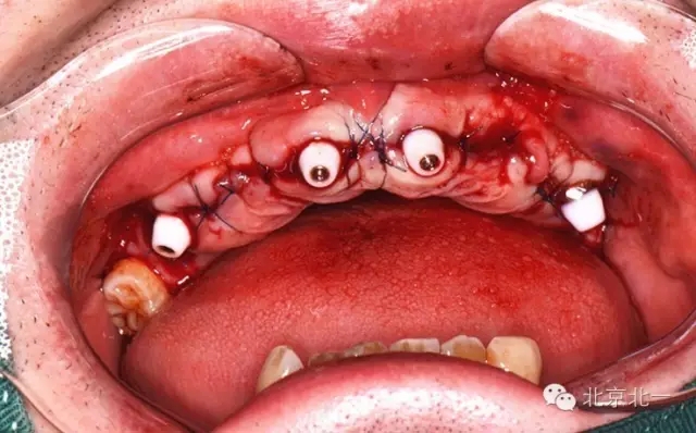 640.webp (3).jpg 640.webp (3).jpg