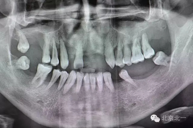 640.webp (7).jpg 640.webp (7).jpg