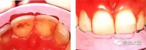 640.webp.jpg 640.webp.jpg