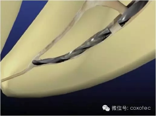 640.webp (3).jpg 640.webp (3).jpg