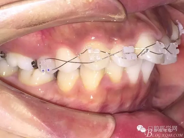 640.webp (1).jpg 640.webp (1).jpg