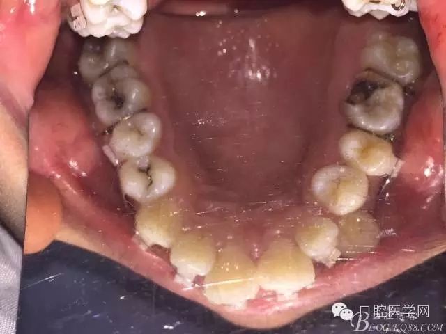 640.webp (2).jpg 640.webp (2).jpg