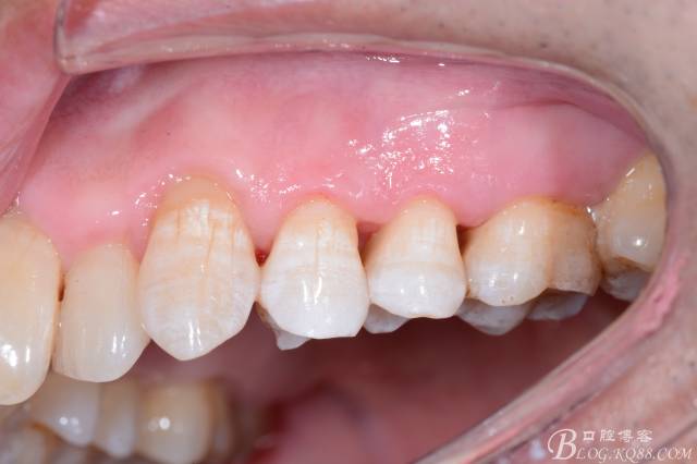 640 (15).jpg 640 (15).jpg