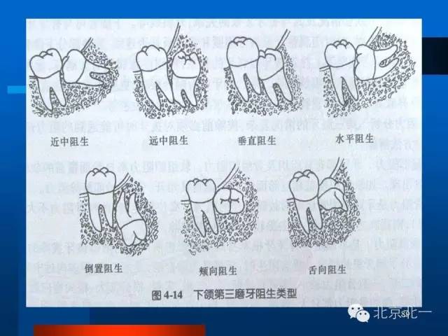 640 (7).jpg 640 (7).jpg