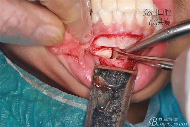 640 (10).jpg 640 (10).jpg