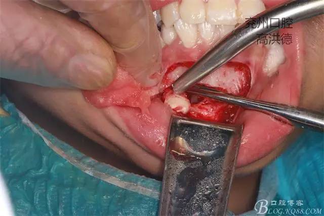 640 (11).jpg 640 (11).jpg