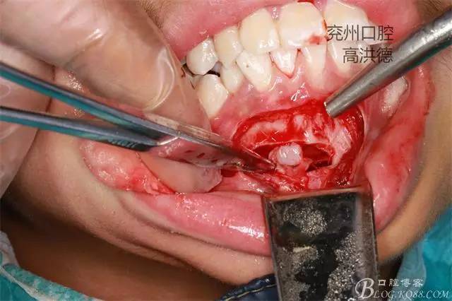 640 (13).jpg 640 (13).jpg