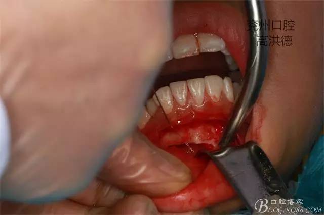 640 (15).jpg 640 (15).jpg