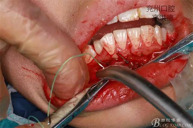 640 (17).jpg 640 (17).jpg