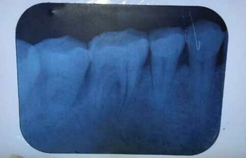 webwxgetmsgimg.jpg webwxgetmsgimg.jpg