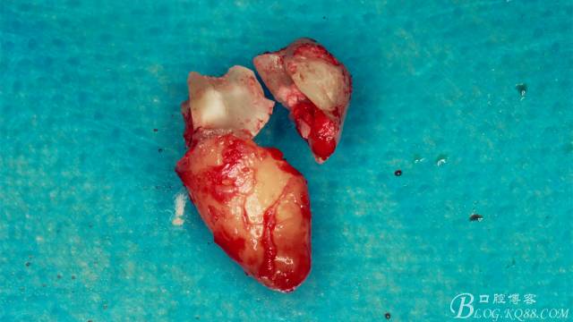 640 (11).jpg 640 (11).jpg