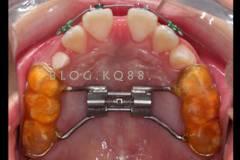 20131035241389700.jpg 20131035241389700.jpg