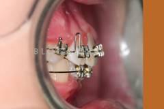 20131035696259835.jpg 20131035696259835.jpg