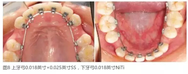 640.webp.jpg 640.webp.jpg