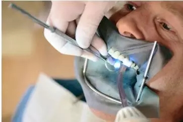 牙醫(yī)為啥要用&ldquo;橡皮障&rdquo;？