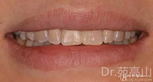 640.webp (8).jpg 640.webp (8).jpg