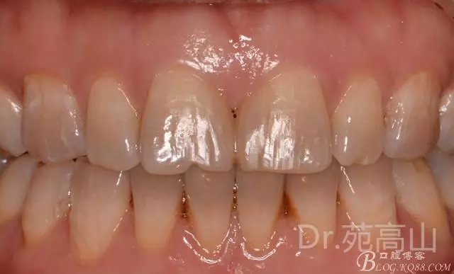 640.webp (17).jpg 640.webp (17).jpg