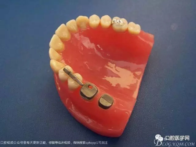 640.webp (3).jpg 640.webp (3).jpg