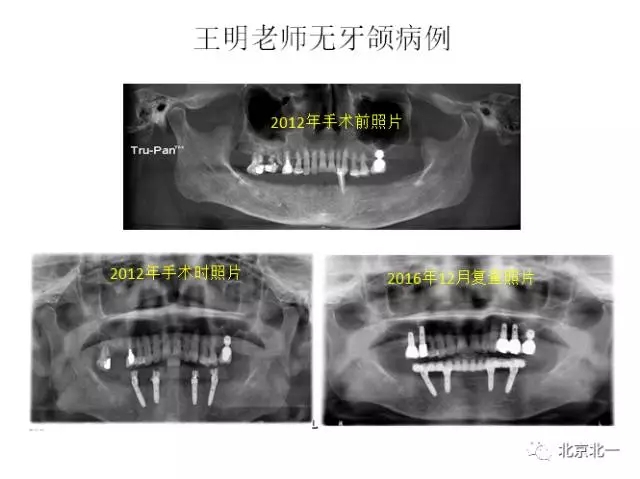 640.webp (1).jpg 640.webp (1).jpg