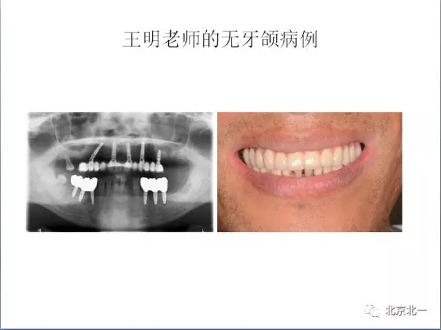 640.webp (2).jpg 640.webp (2).jpg