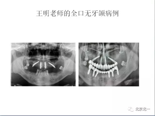 640.webp (4).jpg 640.webp (4).jpg