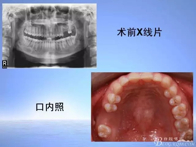 640.webp (3).jpg 640.webp (3).jpg