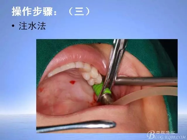 640.webp (22).jpg 640.webp (22).jpg