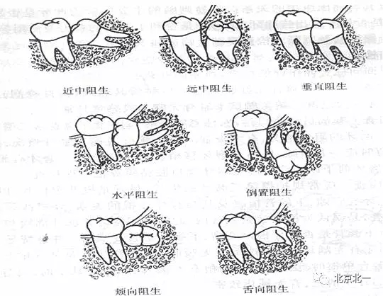 640.webp (1).jpg 640.webp (1).jpg