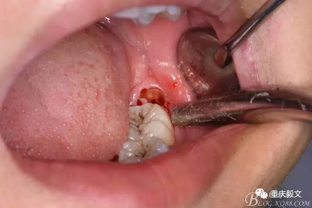 640.webp (8).jpg 640.webp (8).jpg