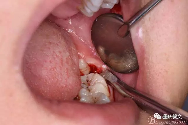 640.webp (11).jpg 640.webp (11).jpg