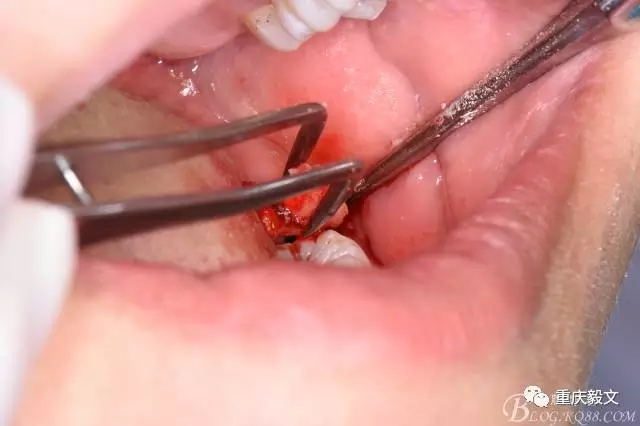 640.webp (16).jpg 640.webp (16).jpg