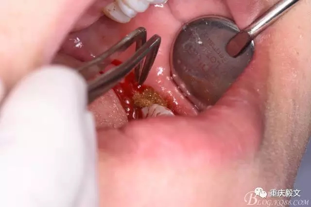 640.webp (19).jpg 640.webp (19).jpg