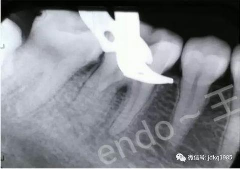 360截圖20170107132048650.jpg 360截圖20170107132048650.jpg