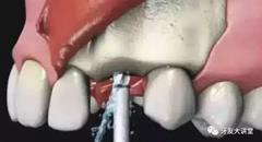 360截圖20170107143305132.jpg 360截圖20170107143305132.jpg