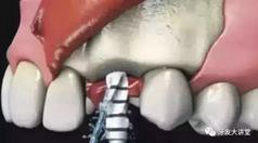 360截圖20170107143318036.jpg 360截圖20170107143318036.jpg