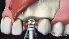 360截圖20170107143330333.jpg 360截圖20170107143330333.jpg