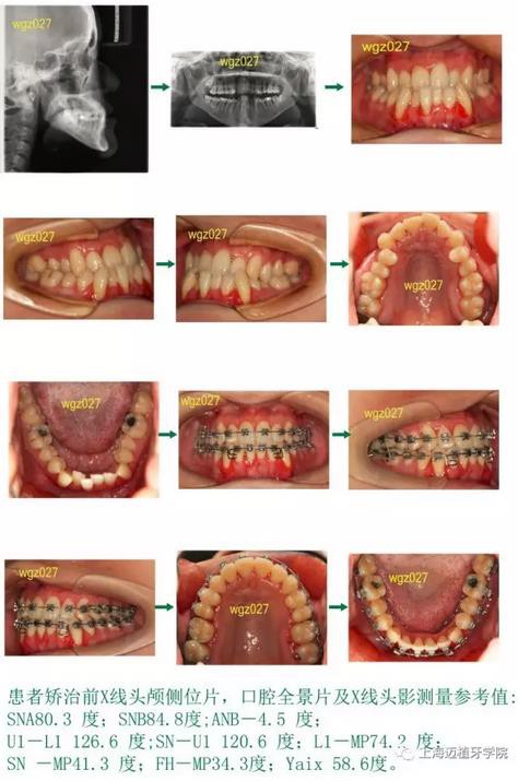 360截圖20170107155935570.jpg 360截圖20170107155935570.jpg