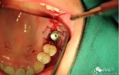 360截圖20170107165437936.jpg 360截圖20170107165437936.jpg