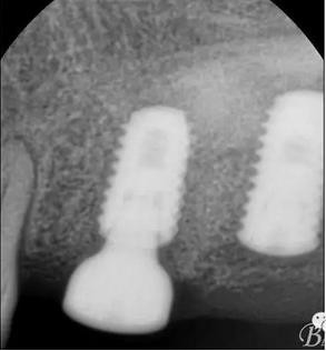 360截圖20170107165447758.jpg 360截圖20170107165447758.jpg