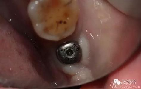 360截圖20170107165542254.jpg 360截圖20170107165542254.jpg