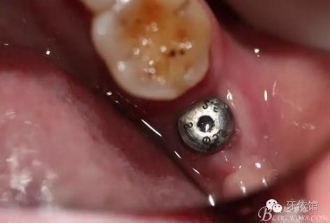 360截圖20170107165632724.jpg 360截圖20170107165632724.jpg