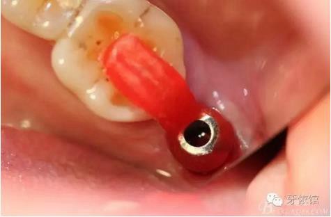 360截圖20170107165642372.jpg 360截圖20170107165642372.jpg