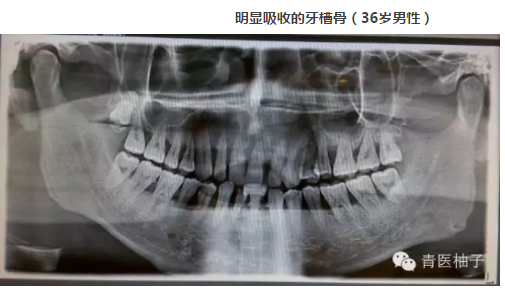 1)M0Y~WW87BWGG3@B7R_~MY.png 1)M0Y~WW87BWGG3@B7R_~MY.png