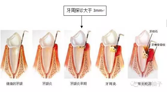 EGB21KN)%YR[)GX`(I3IMZT.png EGB21KN)%YR[)GX`(I3IMZT.png