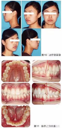 360截圖20170119193915828.jpg 360截圖20170119193915828.jpg