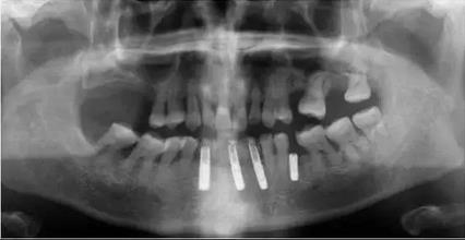 360截圖20170120114927836.jpg 360截圖20170120114927836.jpg