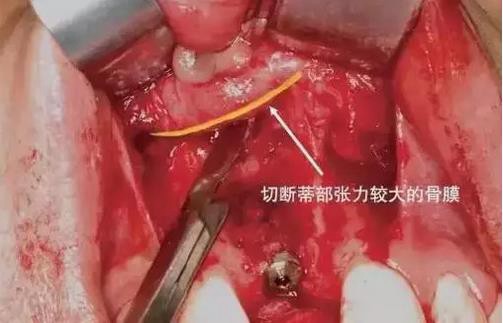 360截圖20170120140703519.jpg 360截圖20170120140703519.jpg