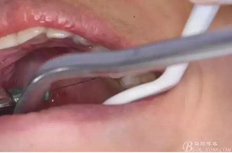 360截圖20170120141418319.jpg 360截圖20170120141418319.jpg