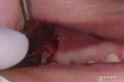 360截圖20170120141604142.jpg 360截圖20170120141604142.jpg