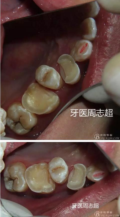 360截圖20170120150128730.jpg 360截圖20170120150128730.jpg